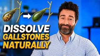 Thumbnail: A Natural Protocol to Dissolve Gallstones (Avoid Surgery!)