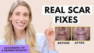 Thumbnail: Fade Scars FAST (and for real) | Dr. Sam Ellis