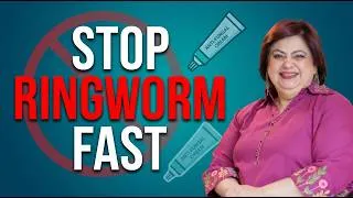 Thumbnail: How to Treat & Prevent Ringworm (Fungal Infection) in Monsoon | Dr. Shehla Agarwal