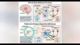 Thumbnail: Parkinson’s disease # neurodegeneration# viral# fyp