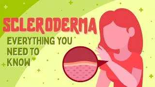Thumbnail: Understanding Scleroderma | Symptoms, Diagnosis, and Management