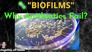 Thumbnail: 285.Biofilms in Medicine: Pathogenesis, Diagnosis & Clinical Relevance | ENT Classes #ent