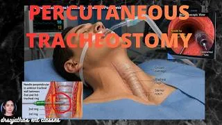 Thumbnail: 284.Percutaneous Tracheostomy in 07 Minutes | Step-by-Step ICU Procedure #ent
