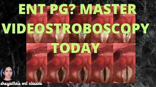 Thumbnail: 283.Videostroboscopy for ENT Residents | Interpretation, Indications & Clinical Pearls
