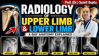 Thumbnail: Radiology of Upper & Lower Limb | X-Ray Anatomy Made Easy | High Yield MBBS Must Know Questions