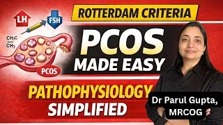 Thumbnail: PCOS Explained Clearly | Diagnosis | Pathophysiology + Rotterdam Criteria | MBBS & NEET PG Made Easy
