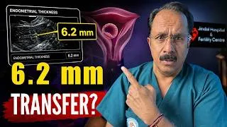 Thumbnail: Lining 7mm Se Kam? Embryo Transfer Karein Ya Cancel? | IVF Doctor Explains