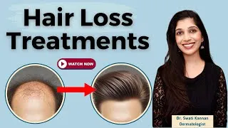 Thumbnail: Stop Hair Loss FAST With These Proven Medical Treatments- Dermatologist Approve Treatments