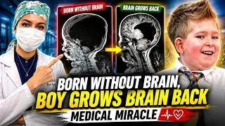 Thumbnail: How a boy  with NO brain grew brain? ##medicalmysteries ##doctorexplains #brain #hydrocephalus 