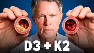 Thumbnail: How to Use D3 and K2 to Heal Arteries