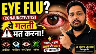 Thumbnail: Eye Flu क्यों होता है? लक्षण, इलाज और बचाव | पूरी जानकारी | Conjunctivitis क्यों है? 