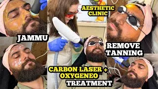 Thumbnail: Carbon Laser & OxyGeneo Skin Treatment for Dullness & Tanning 2026 | Best Aesthetic Clinic in Jammu
