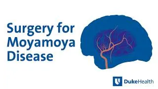 Thumbnail: Moyamoya Cerebral Artery Bypass | Duke Health