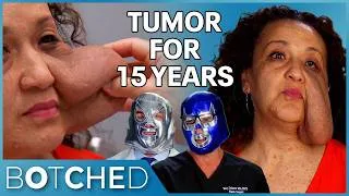Thumbnail: Yamile Has Had A 2-Pound Tumor On Her FACE for 15 Years?! | Botched | E!