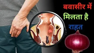 Thumbnail: बबासीर का इलाज। Piles Treatment | Home Remedies for बवासीर