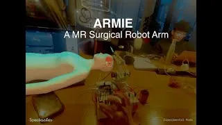 Thumbnail: ARMIE -  Robotic Arm Surgery with Arduino + Spectacles
