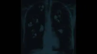 Thumbnail: Elle Coves - Peace [Sped Up]
