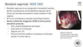 Thumbnail: UKMLA Sexual Health MCQ with Explanation 7