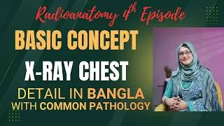 Thumbnail: Complete RadioAnatomy in Bangla II X-Ray Chest II Chest X-ray Anatomy II Dr. Tamanna Mahmud Urmi