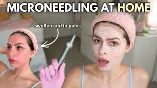 Thumbnail: at home microneedling – am i doing this right?