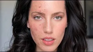 Thumbnail: My Evidence-Based Skincare Routine for Women