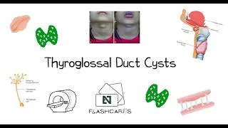Thumbnail: Thyroglossal Duct Cysts - FRCS ENT Exam Essentials