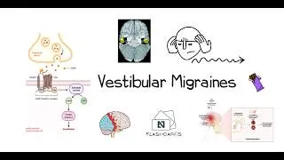 Thumbnail: Vestibular Migraines - ENT Essential