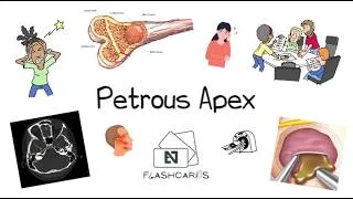 Thumbnail: Petrous Apex - An Overview