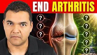 Thumbnail: 10 Ways to Slow Down and Stop Knee Arthritis (Without Surgery)