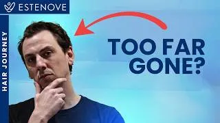 Thumbnail: He Thought His Hairline Was Beyond Saving
