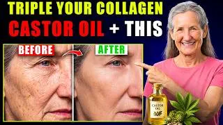 Thumbnail: Rub Castor Oil + THIS Herb on Your Face to Triple Collagen After 60 | Barbara O'Neill