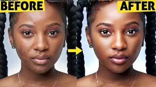 Thumbnail: Skin Retouching That Looks REAL! The Best Frequency Separation Method