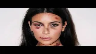Thumbnail: Kim Kardashian Robbed At Gunpoint