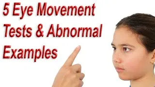 Thumbnail: 5 Eye Movement Tests & Abnormal Examples