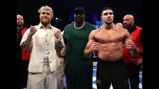 Thumbnail: Tommy Fury ★STARBOY★ Before/After Jake Paul fight