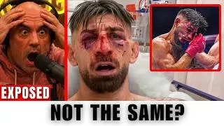 Thumbnail: “HE MAY NEVER BE THE SAME AGAIN!” Joe Rogan Reacts To Ilia Topuria’s Brutal Surgery