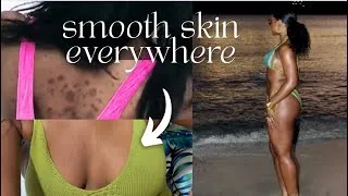 Thumbnail: Bikini Body Skincare Routine: How to Fade Dark Spots, Ingrowns & Texture (Underarms, Bacne & Chest)!