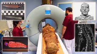 Thumbnail: The Ramesses Murder Mystery Solved - After 3,000 Years