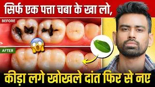 Thumbnail: एक बार में दांत का कीड़ा और दर्द बाहर निकालने का बेहतरीन उपाय - Teeth Cavity | Fit Tuber Hindi