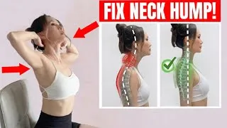 Thumbnail: Fix Neck Hump, Forward Head, Tech Neck & Rounded Shoulders I 10 Min Posture Routine No Equipment