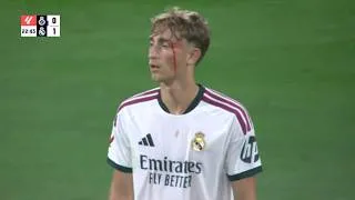 Thumbnail: Dean Huijsen DESTROYING vs Espanyol