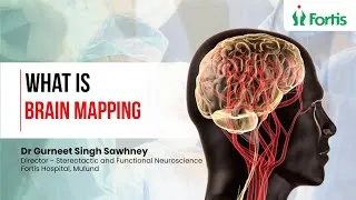 Thumbnail: Awake Brain Surgery & Functional Brain Mapping | Dr Gurneet Singh Sawhney