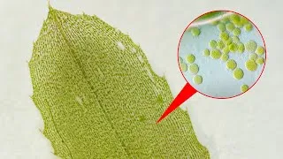 Thumbnail: Elodea under the microscope | Cytoplasmic streaming in plant cells