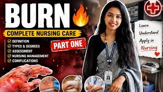 Thumbnail: Burn#norcet #bscnursing #burn #gims #gnmnursingquestionpapers #sgpgilucknow 