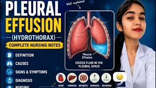 Thumbnail: Plural effusion #bscnursing #gnmnursingquestionpapers #norcet #sarkariexamnews #gims 
