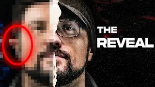 Thumbnail: My Insecurity Reveal... (Microtia)