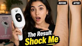 Thumbnail: I Used an At-Home IPL Device for 3 Sessions… Was It Worth It?