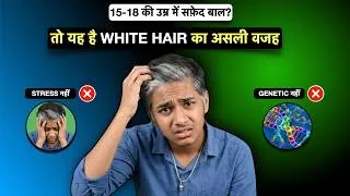 Thumbnail: 15-20 की उम्र में सफ़ेद बाल? Premature White Grey Hair Revealed.