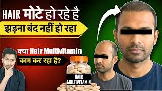 Thumbnail: Hair Thick हो रहे है पर, Hair Fall बंद नहीं हो रहा || Is Multivitamin Working?