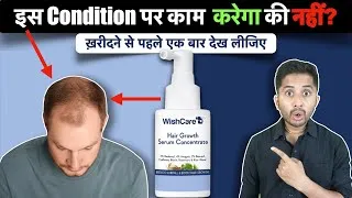 Thumbnail: WishCare Hair Growth Serum Review - Will it Control Hair Fall?